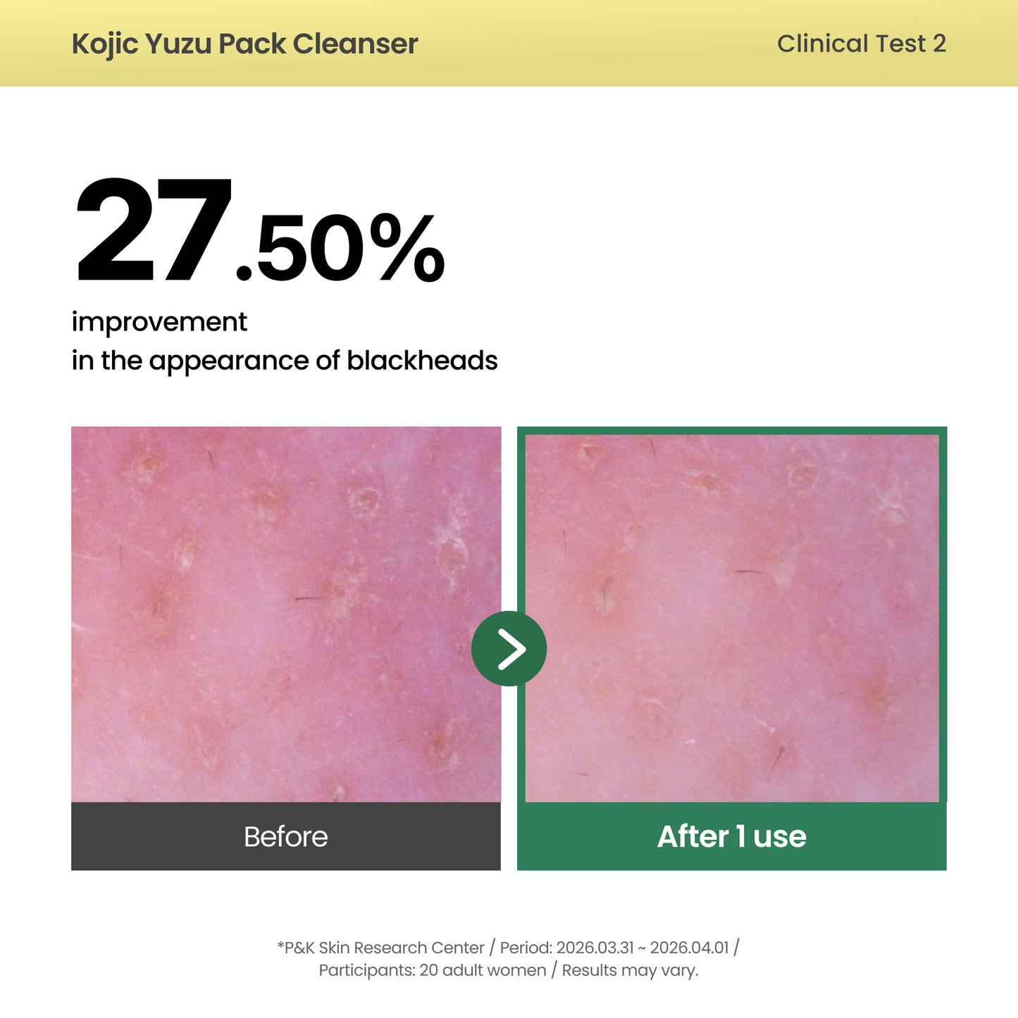 AXIS - Y - Kojic Yuzu Pack Cleanser 60g