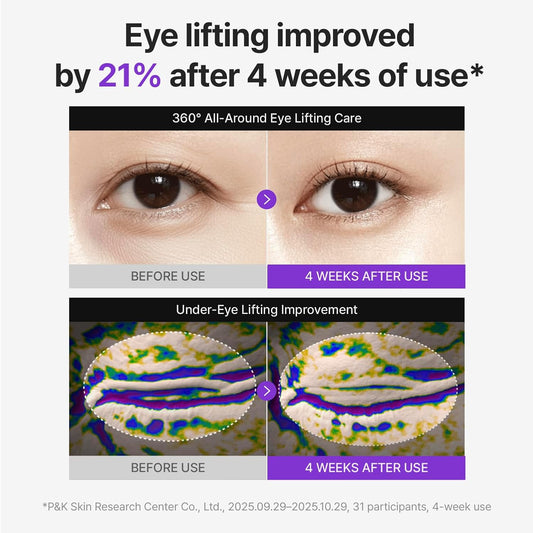 Centellian24 - 360º Shot PDRN Lifting Eye Cream (30ml)