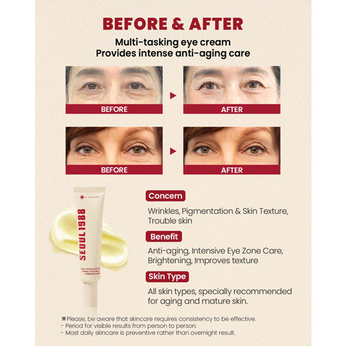 K-Secret - SEOUL 1988 Eye Cream Retinal Liposome 4% + Fermented Bean 30ml