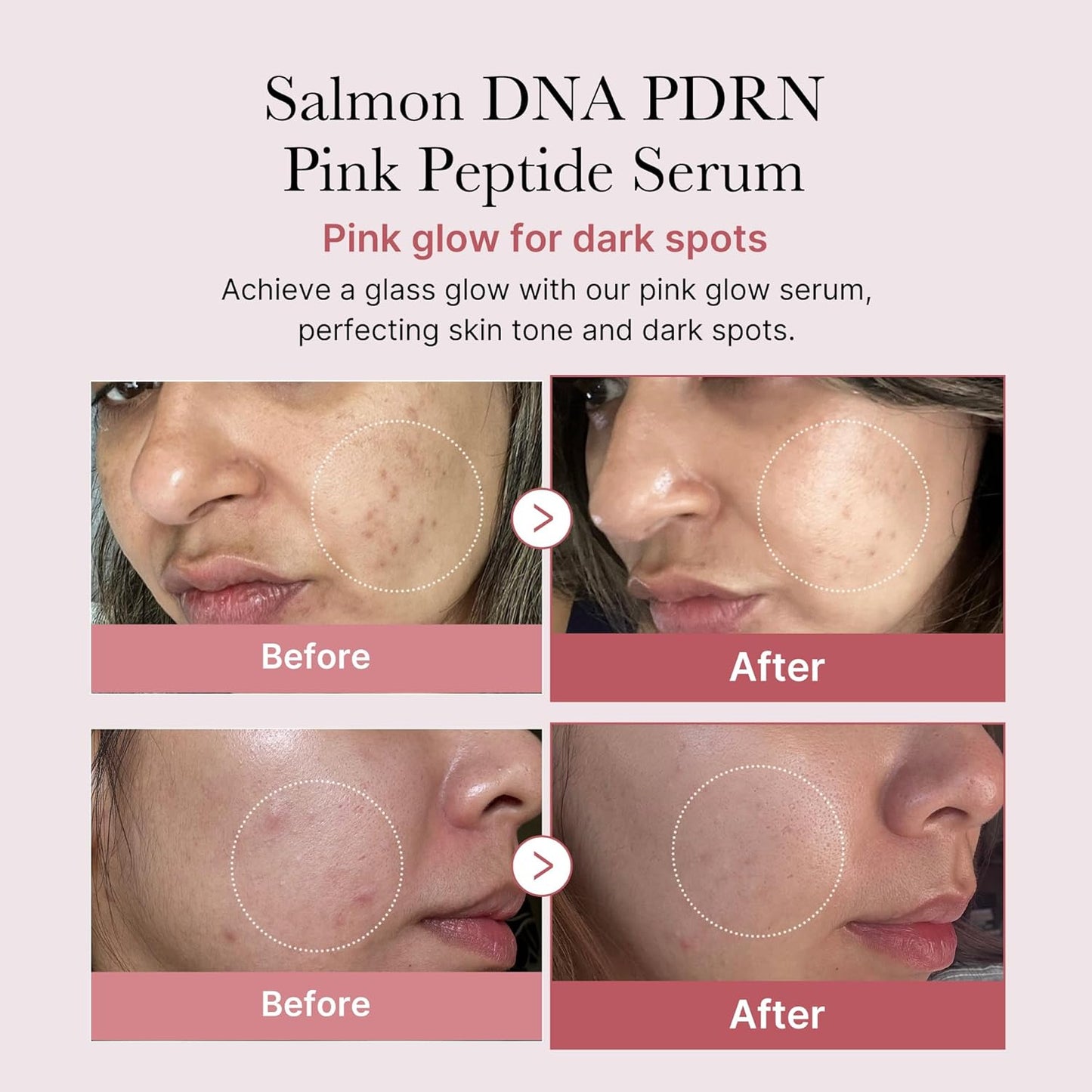 Medicube - PDRN PINK PEPTIDE SERUM 30ML