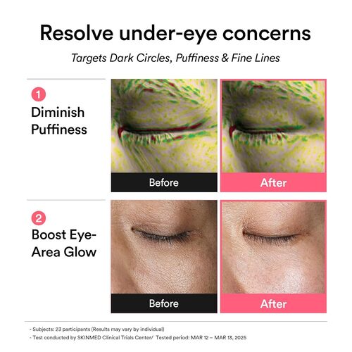 Abib - PDRN RETINAL EYE PATCH GLOW JELLY 84g (30 pares)