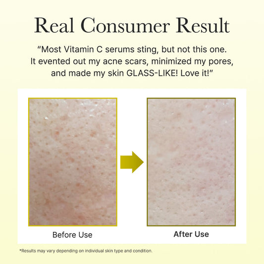 Arencia - Vitamin C Booster Shot 30ml