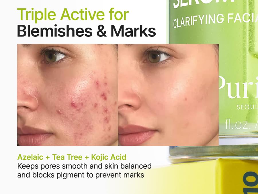 Purito - Azelaic Acid 10 Kojic Azulene Serum 30ml