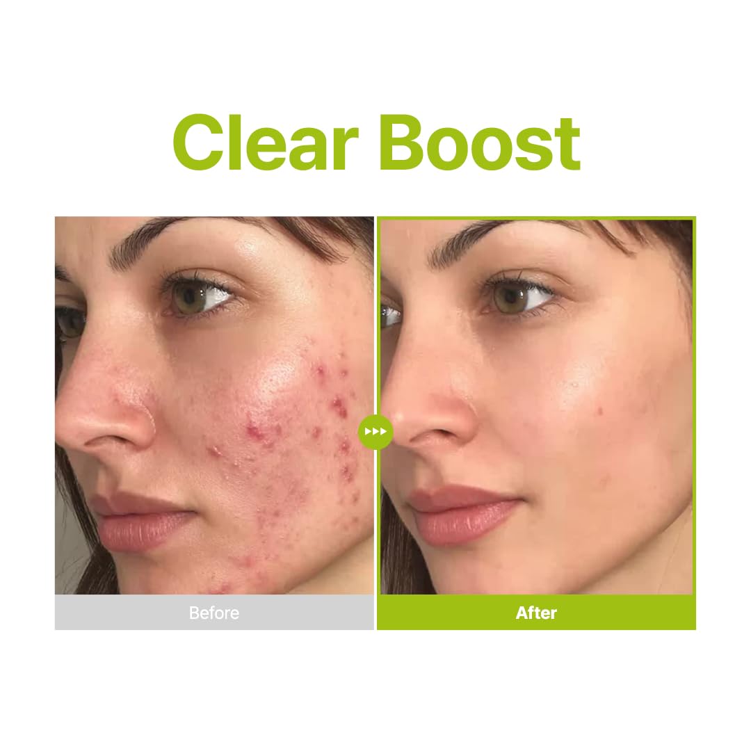 Purito - Azelaic Acid 10 Kojic Azulene Serum 30ml