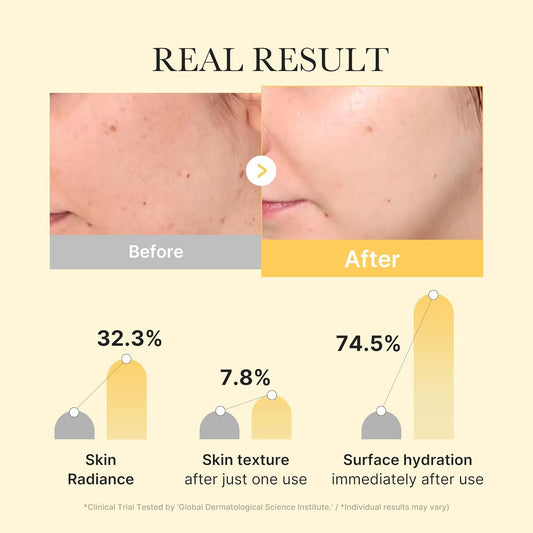 Medicube - Kojic Acid Turmeric Gel Mask