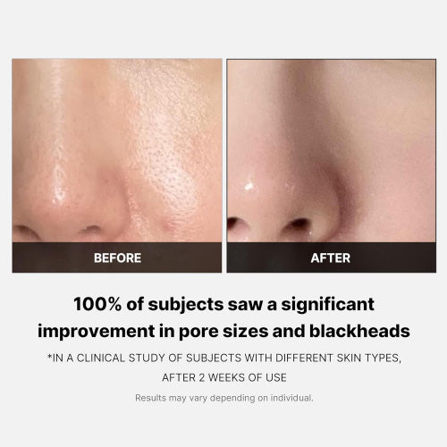 Medicube - Zero Pore Pad 2.0 (70ea)